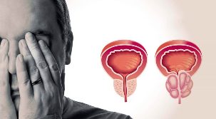 Himsog ug namaga nga prostate