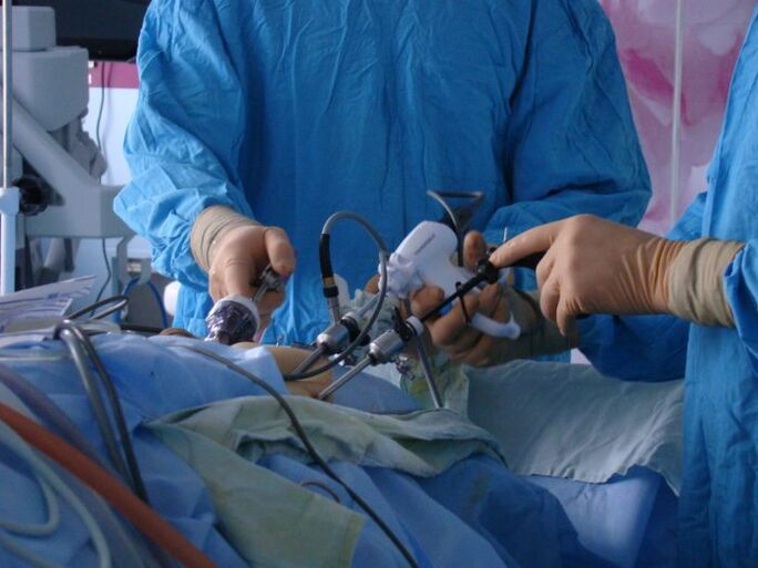 surgical pagtambal sa prostatitis