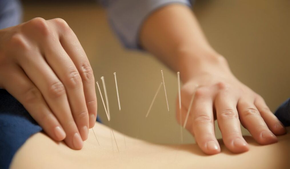 Ang acupuncture usa ka sagad nga pamaagi sa pagtambal sa laygay nga prostatitis