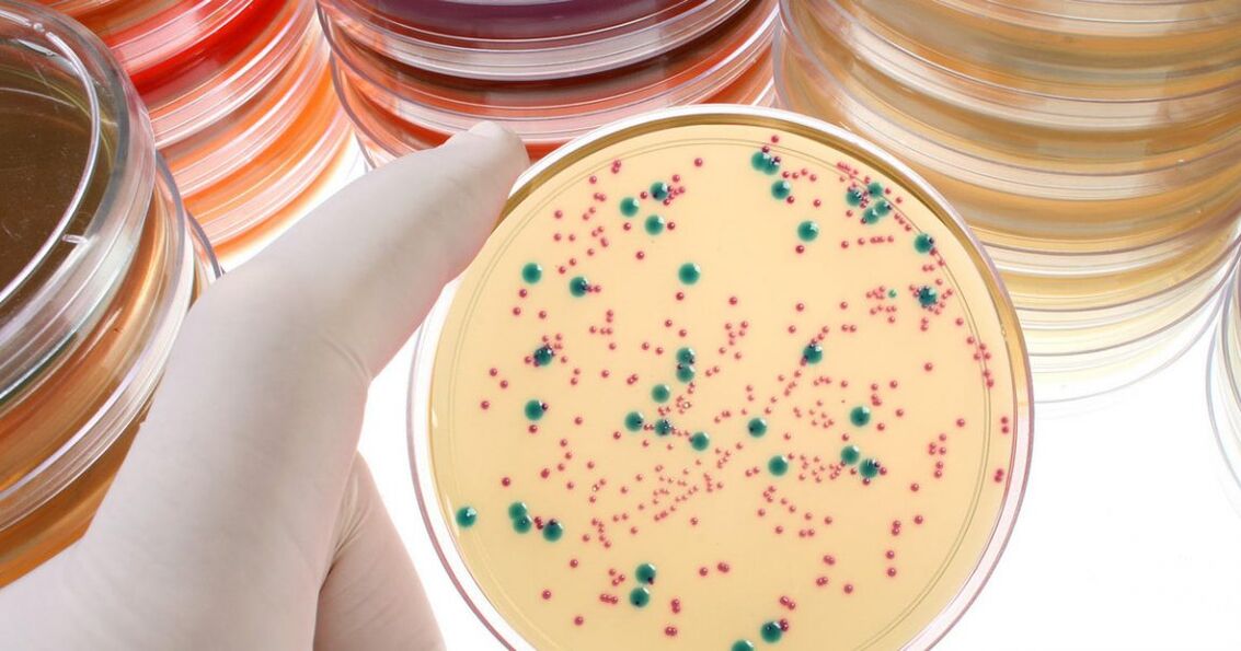 Ang bacterial chronic prostatitis namatikdan pinaagi sa pag-analisar sa ihi ug prostate secretions